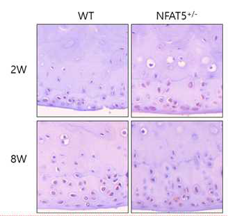 DMM 유도 후 2주, 8주에 WT 마우스와 NFAT5+/- 마우 스의 무릎내 연골조직에서 SOX-9에 대한 면역조직화학염색. (unpublished data)