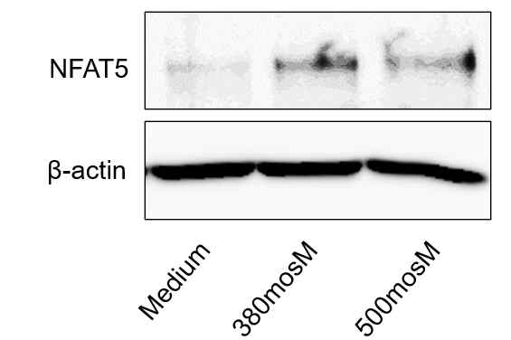 WT 마우스의 연골세포를 분리배양하여 고삼투압 자극하고 24시간후에 측정한 NFAT5의 단백질 발현양 (n=3). (unpublished data)