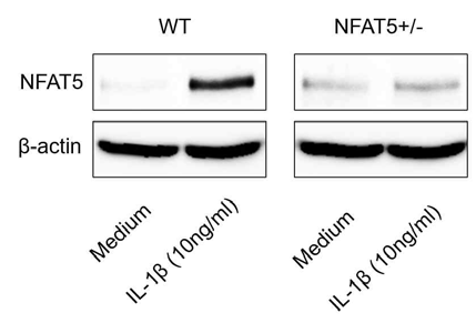 WT 마우스와 NFAT5+/- 마우스의 연골세포를 분리배양하여 IL-1β (10 ng/mL)로 자극하고 24시간후에 측정한 NFAT5의 단백질 발현양. (unpublished data)