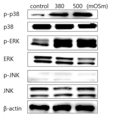 WT 마우스의 연골세포를 분리배양하여 고삼투압으로 자극하고 24시간 후에 WB로 측정한 p-p38/p38, p-ERK/ERK, p-JNK/JNK의 단백질 발현양. (unpublished data)