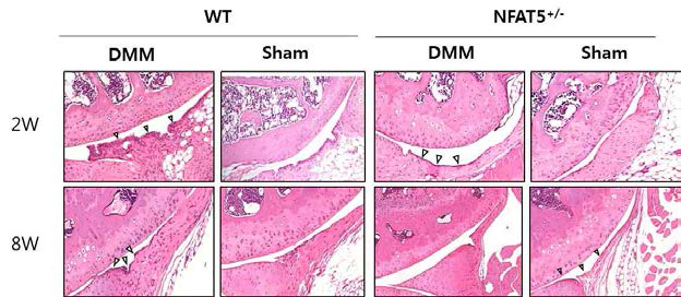 DMM 유도 후 2주, 8주후에 WT 마우스와 NFAT5+/- 마우스의 무릎조직 H&E 염색 (unpublished data)