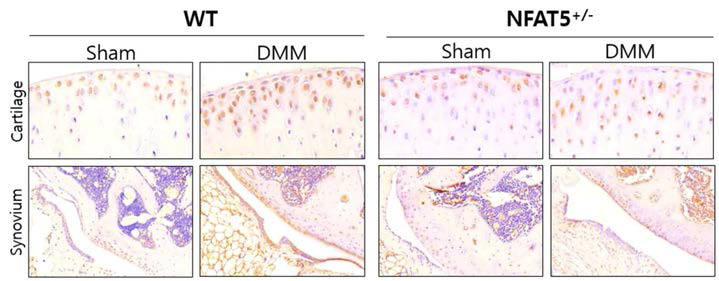 DMM 유도 후 2주에 WT 마우스와 NFAT5+/- 마우스의 무릎 내 연골과 활막에서 CCL2에 대한 면역조직화학염색 (unpublished data)