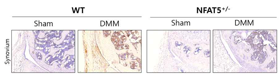 DMM 유도 후 2주에 WT 마우스와 NFAT5+/- 마우스의 무릎 내 활막조직에서 F4/80에 대한 면역조직화학염색 (unpublished data)