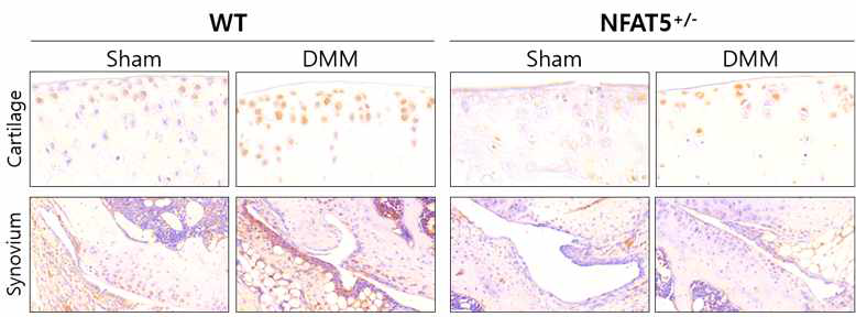 DMM 유도 후 8주에 WT 마우스와 NFAT5+/- 마우스의 무릎 내 연골과 활막 조직에서 IL-1β에 대한 면역조직화학염색 (unpublished data)