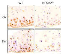 DMM 유도 후 2주, 8주에 WT 마우스와 NFAT5+/- 마우스의 무릎 내 연골조직에서 TNF-α에 대한 면역조직화학염색 (unpublished data).