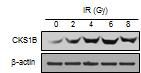 CKS1B 발현에 방사선 선량이 미치는 영향