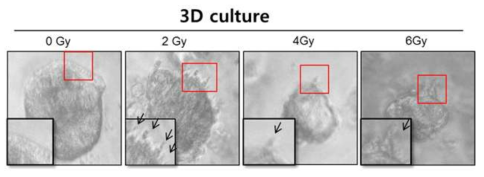 3D culture 상에서 방사선에 의해 유도된 사상위족 유사구조의 중가