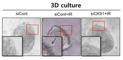 3D culture 상에서 방사선에 의해 유도된 생성된 사상위족 유사구조에 CKS1B 손실의 효과