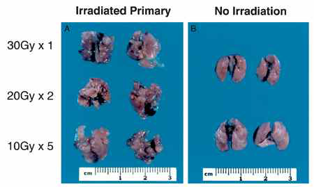 Local control of primary LLC-LM tumor with radiotherapy leads to the growth of lung metastases (국외논문 발췌3)