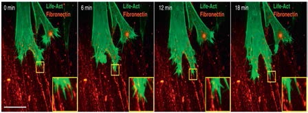 Live-cell imaging of an ovarian carcinoma cell (A2780) migrating invasively on fibronectin-rich fibrillar matrices (red: fibronectin; green: Life-Act GFP for visualization of the actin cytoskeleton). (국외논문 발췌5)