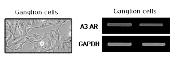 망막신경절세포주로부터 A3 AR 발현 분석. 위상차 현미경을 통한 신경절세포주 사진 (왼쪽), RT-PCR 분석을 통해 A3 AR 발현분석(오른쪽)