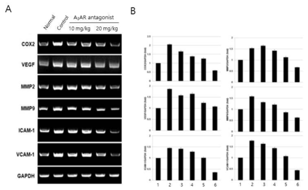 A3AR antagonist의 경구 투여 후 안압상승 마우스모델의 안구에서 염증 반응(COX2, MMP2, MMP9, ICAM-1, VCAM-1) 및 신생혈관 반응(VEGF)과 관련된 유전자들의 발현 분석. RT-PCR 분석 (A)과 발현량의 정량분석(B). 1: Normal, 2: Control, 3-4: A3AR antagonist(10mg/kg), 5-6: A3AR antagonist(20mg/kg)