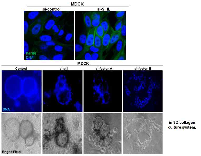 Loss of STIL leads to abnormal expression of pard6, and prevents 3-D cyst foramtion