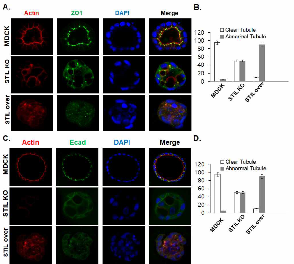 Loss/gain of STIL prevents apico-basl polarity in 3-D cultured systems