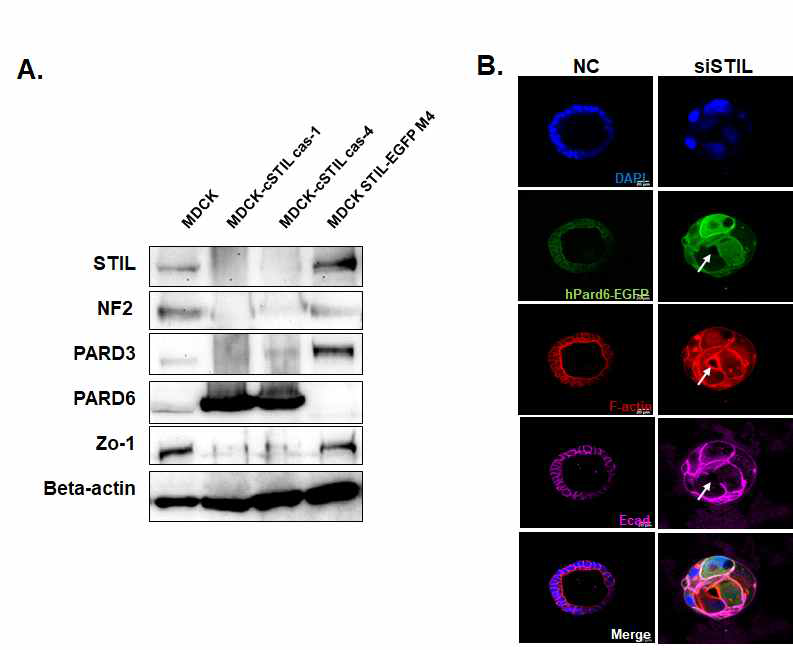STIL regulates apical components(pard6a or NF2, pard3) in a differential manner