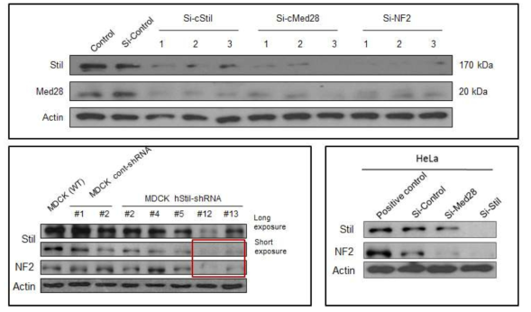 STIL is required for the expression of MED28 and NF2, and MED28 and NF2 are required for their normal expression in each other