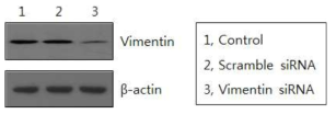 Vimentin 유전자 knockdown에 의한 단백질 발현 수준