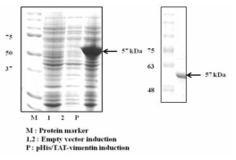 CPP-vimentin (TAT-Vimentin) 단백질 발현 및 정제