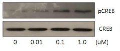 DP cells에서 CPP-vimentin에 의한 CREB의 phosphorylation