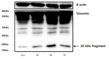 DP cells에서 H2O2에 의한 endogenous vimentin 단백질의 cleavage