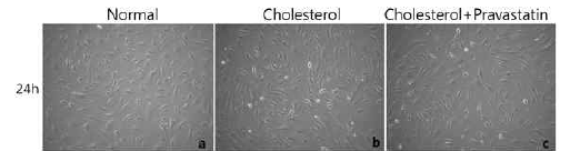 정상 HFLS 세포에 Cholesterol과 Pravastatin 처리 후 24시간 후 세포 모양