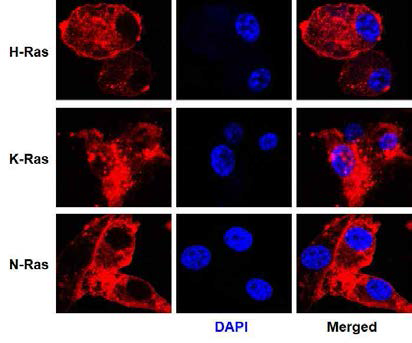 각 Ras 암유발 유전자 단백질 발현의 확인. 각각이 세포주를 일정 시간동안 단백질 발현 후 각 Ras단백질에 특이적인 항체를 사용하고 세포 내 위치를 공촛점 형광현미경을 이용하여 확인하였다. 세포 핵의 염색은 DAPI염색을 이용하여 핵 분획을 확인하였으며, 다른 동위효소와는 달리 K-Ras의 경우에만 핵분획에서 특이적으로 확인할 수 있었다