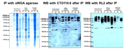 세포 핵 분획 내 O-GlcNAcylation되는 단백질 들의 확인. 각 특정의 단백질 발현 유도체로 발현시키지 않거나 활성화 된 K-Ras와 활성이 없는 돌연변이체 K-Ras 단백질을 일정 시간 발현시킨 후 각 세포 핵 분획(각 lane당 3 mgr)을 얻어 Succinylated Wheat Germ agglutinin agarose를 이용하여 precipitation 후 각각 O-GlcNAcylation 된 단백질 부위에 특이적으로 반응하는 항체(CTD110.6과 RL2)로 O-GlcNAcylated 단백질을 확인하였다. 각 항체는 단백질의 특정 부위를 지정하고 O-GlcNAcylated 단백질을 확인할 수 있는 것으로 알려져 있다. 이 결과 활성화된 K-Ras단백질의 발현에 의해 세포의 핵 내 단백질 번역 후 당 수식화과정이 특이적으로 일어 남을 확인하였다. T: 총 세포 추출물 N: 세포 핵 분획, C: 세포질 분획