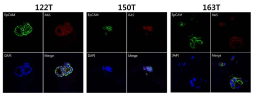 환자유래세포 122T, 150T, 163T의 Immunofluorescence staining 사진