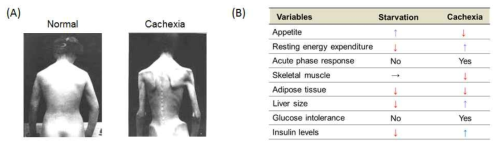 악액질에 의한 체중감소 (A) 및 기아 (starvation)/악액질 (cachexia) 비교