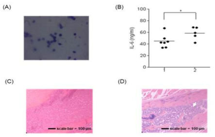 Examination of IL-6 levels depending on the presence of residual HEL cells after treating mice having HEL cells with Ara-C (10-2M/kg). To examine whether IL-6 levels associated with the presence of AML cells following Ara-C treatment, IL-6 levels was measured using ELISA. After Ara-C treatment, each mouse was sacrificed and Wright Giemsa stain was then performed to determine the presence of HEL cells. * indicates statistically significant. (A) Giemsa wright staining of HEL cells harvested from mice bone marrow; (B) The expression levels of IL-6: 1: mice having no HEL cells following Ara-C treatment, 2: mice having HEL cell following Ara-C treatment. (C) Mouse bone marrow having no HEL cells. (D) Mouse bone marrow having HEL cells