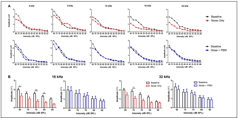 소음노출 이후 PBM 유무에 따른 ABR peak 1 amplitude의 변화. (A) 5개의 검사 주파수(4, 8, 12, 16, 32 kHz)에서 소음노출 전과 14일 후 나타나는 Peak 1 amplitude의 결과, (B) Supra-threshold 수준에서 나타나는 변화를 확인하기 위한 평균 비교분석 (평균과 표준편차, Two-way ANOVA with Tukey post hoc, ** p<0.01, * p<0.05)