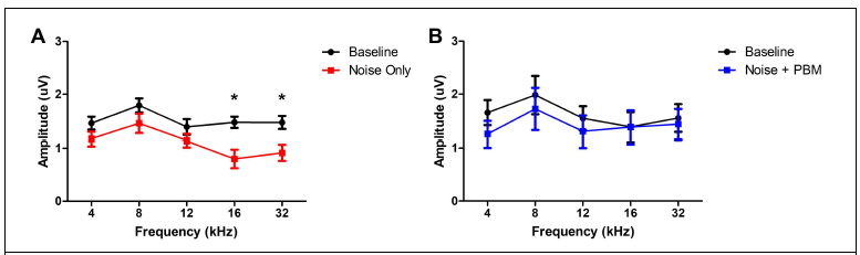소음노출 이후 PBM 유무에 따른 supra threshold 수준에서 ABR peak 1 amplitude의 변화. (평균과 표준편차, Two-way ANOVA with Tukey post hoc, * p<0.05)