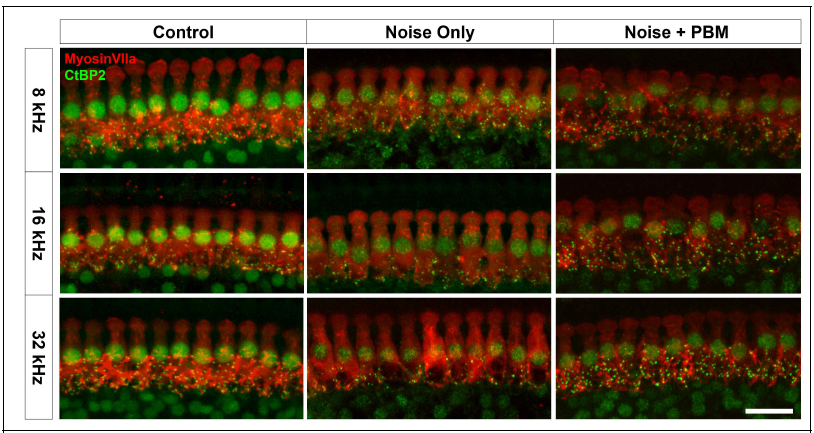 소음노출 14일 후 PBM 유무에 따른 유모세포(MyosinVIIa, 빨간색)와 시냅스 (CtBP2, 초록색)의 변화. 청력검사에 진행되었던 주파수들 중 cochlea에서 첨단부, 중간부, 하단부(8, 16, 32 kHz)에 해당되는 기저막 부분에서 유모세포와 시냅스의 변화를 관찰(Sacle bar: 40 um)