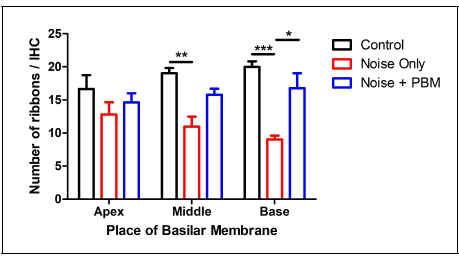 소음노출 14일 후 PBM 유무에 따른 유모세포(MyosinVIIa, 빨간 색)와 시냅스(CtBP2, 초록색)의 변화. 청력검사에 진행되었던 주파수들 중 cochlea에서 첨단부, 중간부, 하단부(8, 16, 32 kHz)에 해당되는 기저막 부분에서 유모세포와 시냅스의 변화를 관찰 (Sacle bar: 40 um)