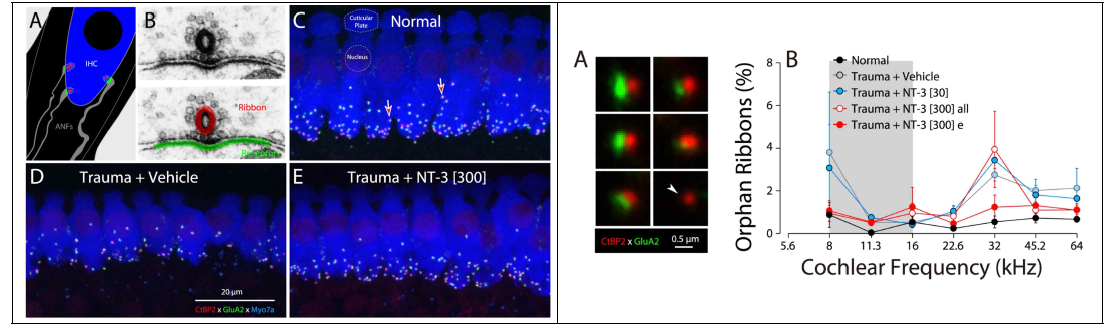 소음노출 이후 neurotrophin-3(NT3)를 난원창으로 주입한 군에서 대조군에 비해 시냅스의 숫자가 정상군으 수준으로 유지됨