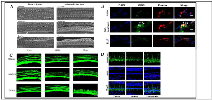 코르티기관에서 저출력 레이저 조사의 효과. A. 소음노출 이후 보호 및 회복 효과 B. 세포괴사 과정에서 레이저 조사의 효과. C: 양측성 레이저의 효과. D: 유모세포 신경연접 및 청각신경에서 신경독성 약물 처리 후 레이저 조사의 효과