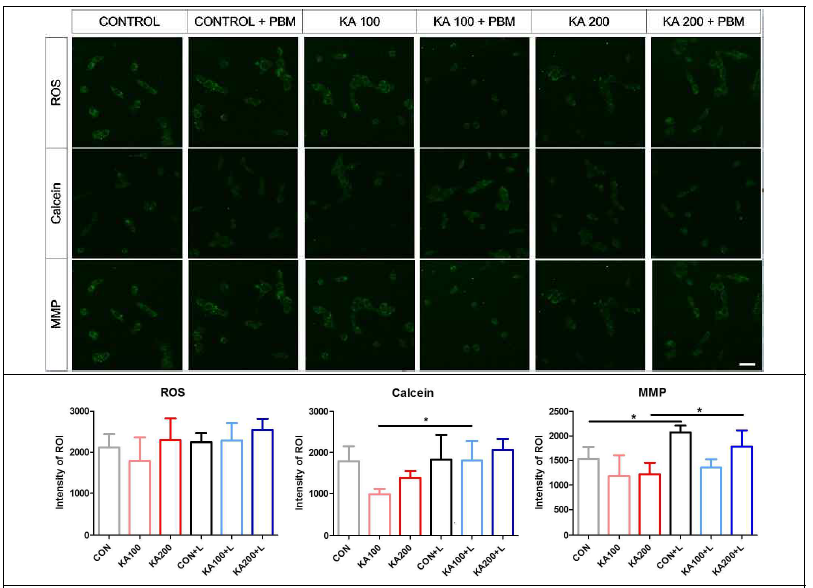 카인산 처리 및 레이저 조사 이후 나타나는 세포 내 ROS, Ca ion, MMP의 변화
