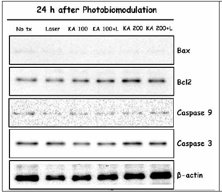 카인산 처리 및 레이저 조사 후 나타나는 세포 내 apoptosis 관련 단백질의 변화 (Bas, Bcl2, Caspase 9, Caspase 3)