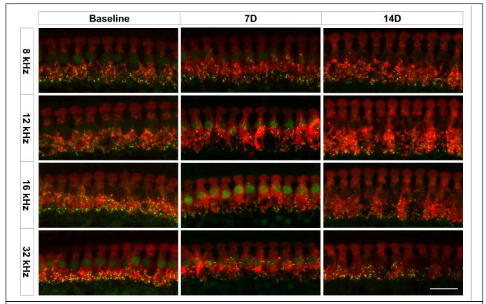 소음노출 7일과 14일 후 나타나는 유모세포와 시냅스의 변화. 청력검사에 진행 되었던 4개의 주파수 (8, 12, 16, 32 kHz)에 해당되는 기저막 부분에서 유모세포와 시냅스의 변화를 관찰(빨간색: MyosinVIIa positive, 유모세포, 초록색: CtBP2 positive, 시냅스, Sacle: 40 um)