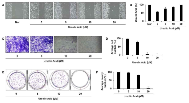 Ursolic acid 의 유방암세포에서의 항암효과