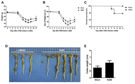 Ro60 과발현을 통한 DSS-induced colitis 완화