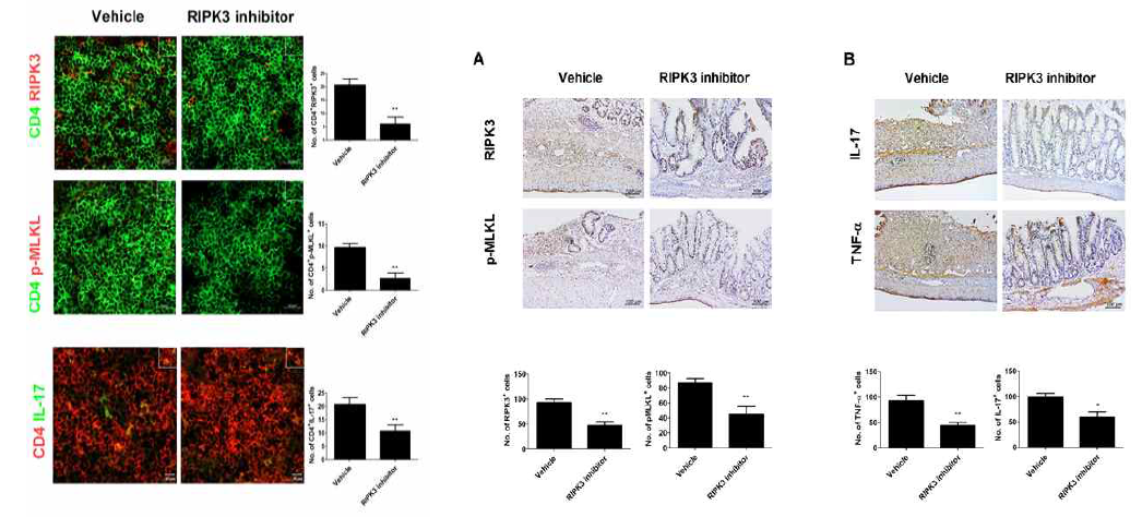 RIPK3 억제제를 통한 염증성세포 사멸 및 염증 감소