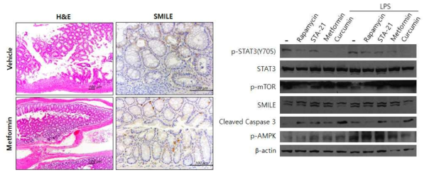 Metformin 주입을 통한 장 내 SMILE 발현 증가 / mTOR-STAT3 신호 조절 인자를 통한 세포 사멸 조절