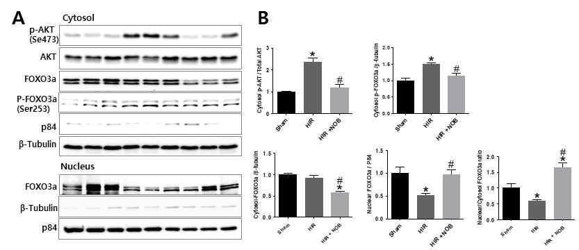 간장 허혈 및 재관류 손상 시 Nobiletin에 의한 FOXO3a 발현 및 AKT 인산화 변화를 간 조직에서 핵/세포질 분리 후에 Western blot 방법으로 분석