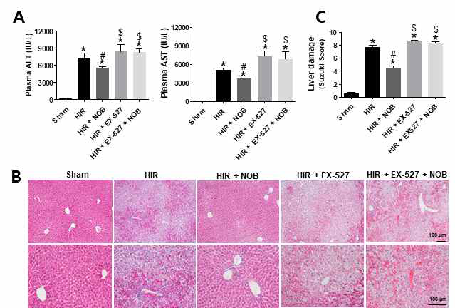 Nobiletin 에 의해 감소된 간장 허혈 및 재관류 손상이 SIRT1 저해제(Ex-527) 전처리 시, 그 효과가 없어짐. (A) 혈액 내 간손상 지표 ALT, AST 농도(B) 조직학적 분석 (H&E 염색), (C) 간 조직 손상 정도의 정량화