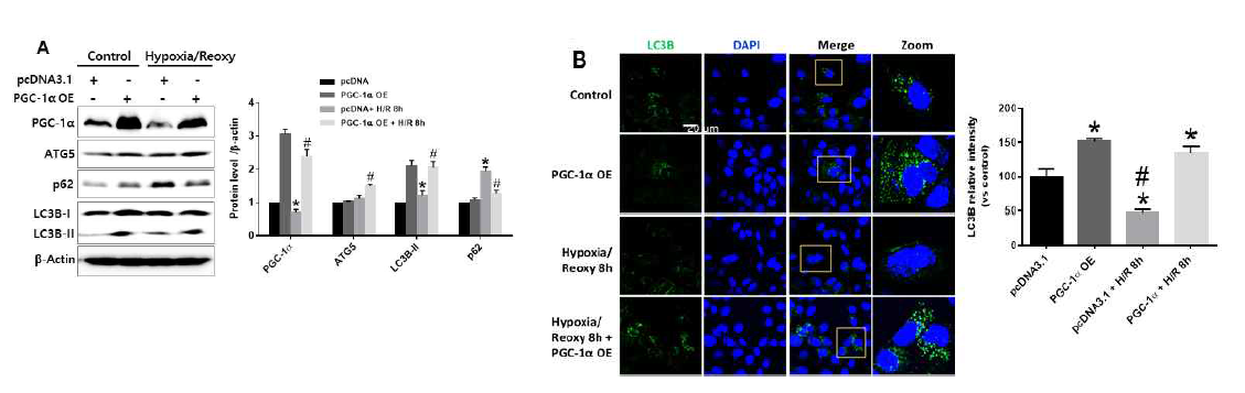 PGC-1α를 과발현시킨 FL83B 세포주에 H2O2를 처리 후, PGC-1α, 자가포식 조절인자(ATG5, p62, LC3B) 발현 변화를 Western blot으로 분석하고 정량(A), LC3B 발현을 형광 염색법으로 분석(B)