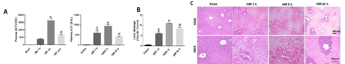 간장 허혈 및 재관류 손상 후 시간별로 혈액과 간 조직을 분리하여 손상 정도 분석. (A) 혈액 내 간 손상 지표 ALT, AST 농도 (B) 조직학적 분석(H&E염색)