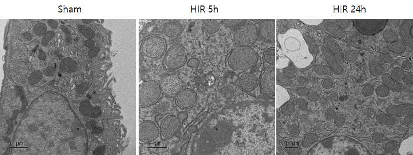 간장 허혈 및 재관류 손상 후 시간별로 간 조직을 분리/고정한 뒤, 전자현미경을 통해 미토콘드리아의 모양 변화 분석