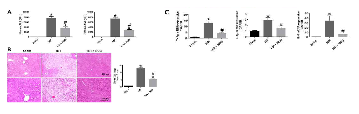 간장 허혈 및 재관류 손상 시 Nobiletin에 의한 간 조직의 손상 정도 분석. (A) 혈액 내 간 손상지표 ALT, AST 농도 (B) 조직학적 분석(H&E 염색) (C) pro-inflammatory cytokine 유전자 분석