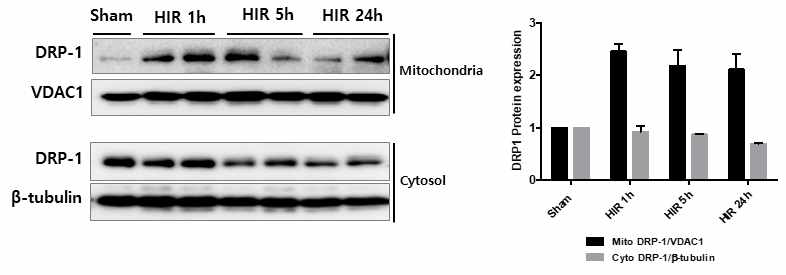 간장 허혈 및 재관류 손상 후 시간별로 간 조직에서 미토콘드리아-세포질을 분리하여 Drp1 단백질의 세포 내 위치 및 발현 변화 분석